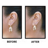 Lobe Wonder